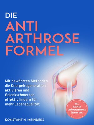 cover image of Die Anti Arthrose Formel